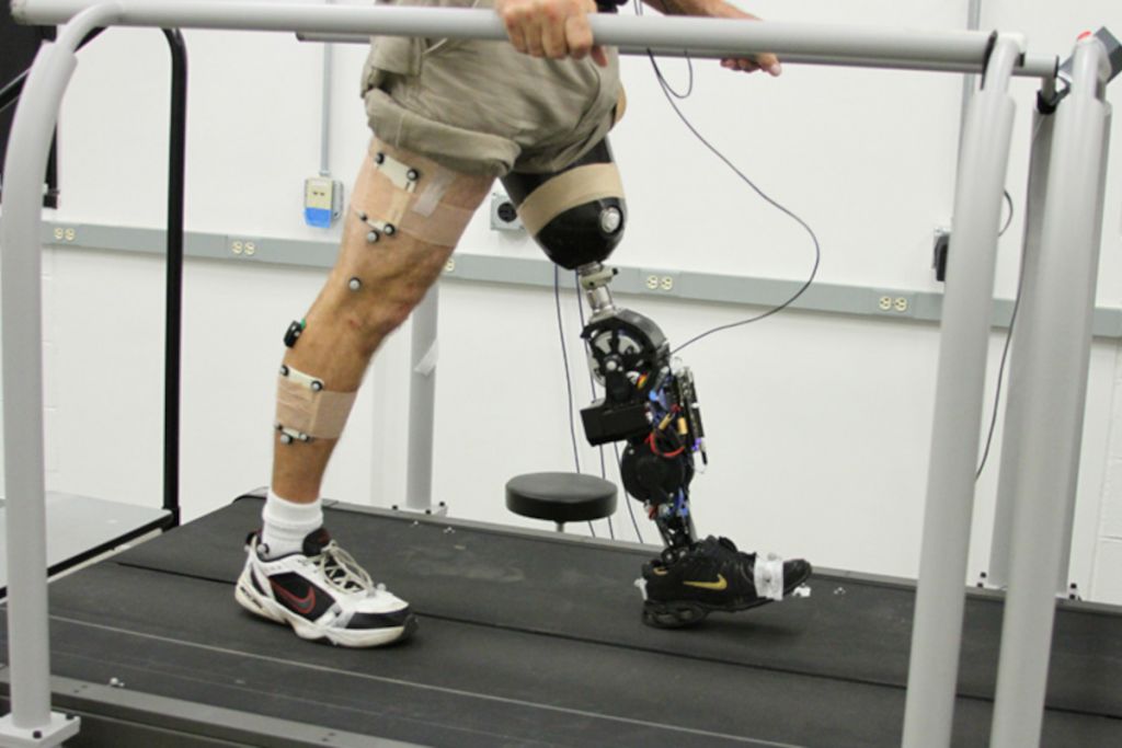 Artificial leg for John Britto