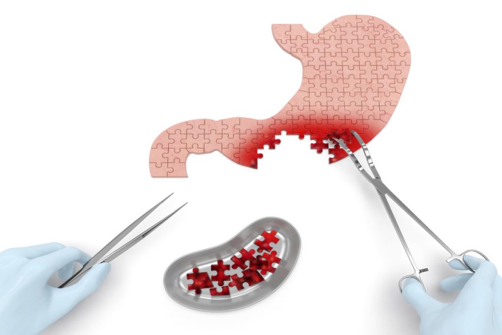 Cancer treatment for Rajan