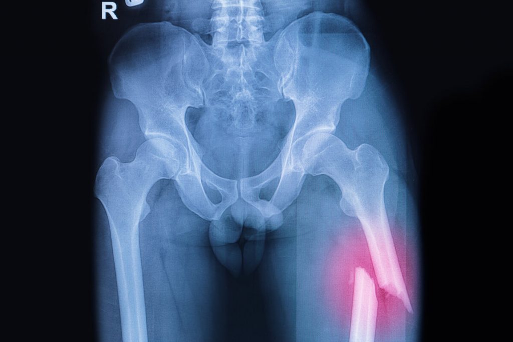 Surgery for Thomas Joseph